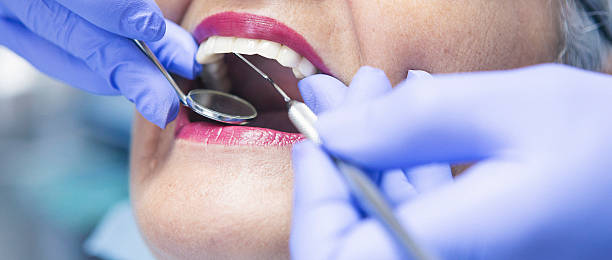Best Emergency Cosmetic Dentistry in Sonoma State University, CA